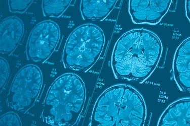 Neurologia | HCI