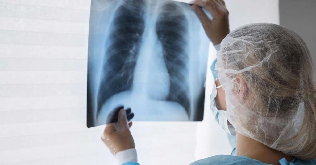 Raio X Torácico_ A Importância de um Diagnóstico Preciso
