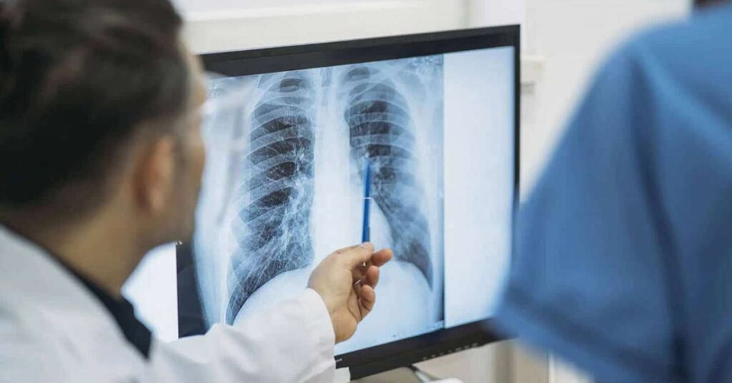 Raio X Torácico_ Preparação e o que Esperar