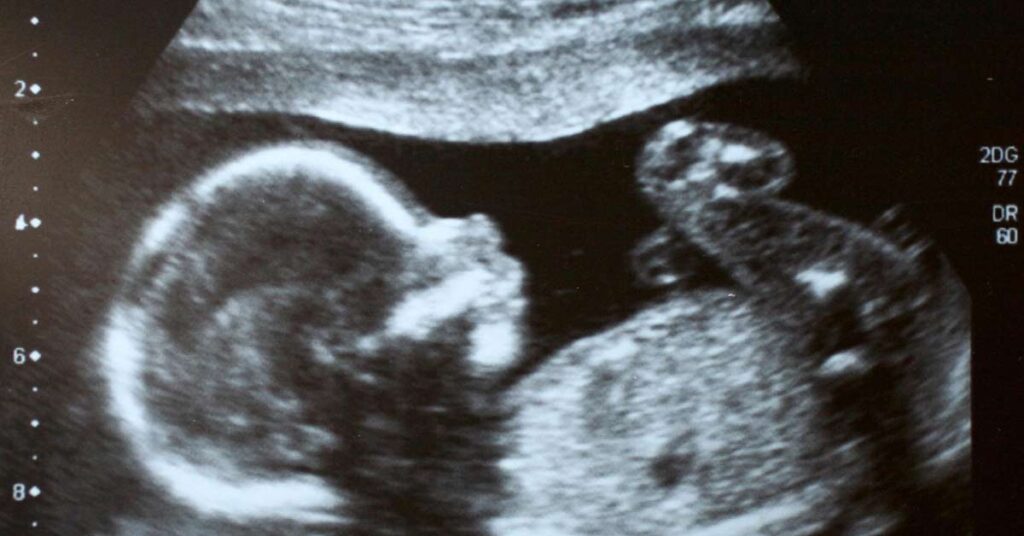 Como Interpretar os Resultados do Ultrassom Fetal