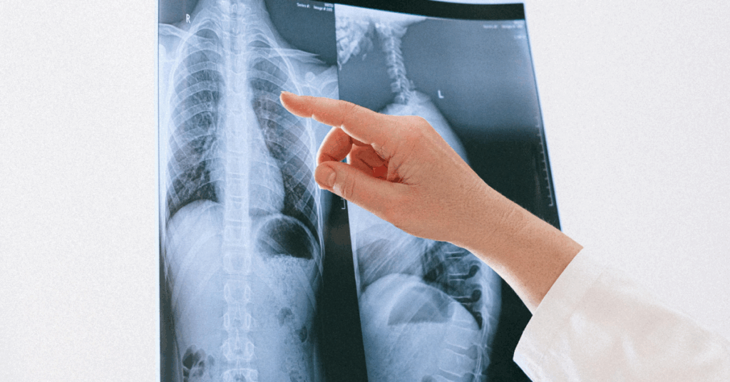 Raio X da Coluna_ Entenda os Diferentes Tipos e Seus Propósitos